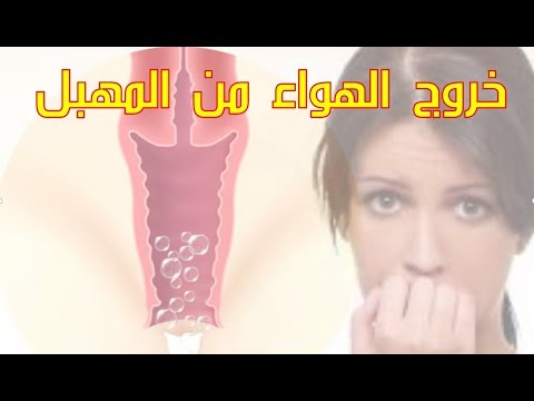 العلاج الاكيد للخراب الصوت من المنطقه