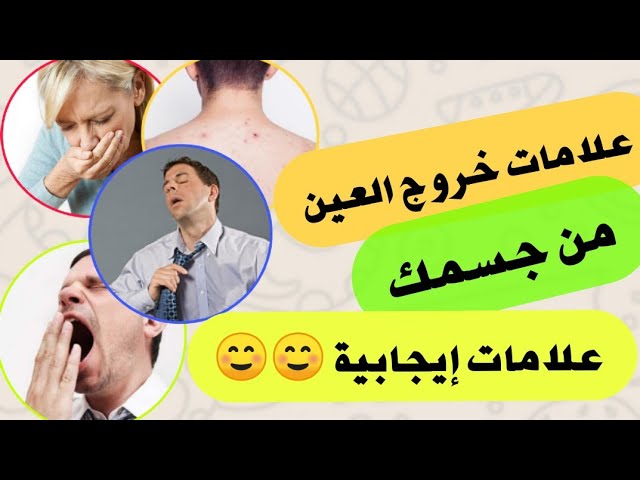 ماعلامات خروج الحسد