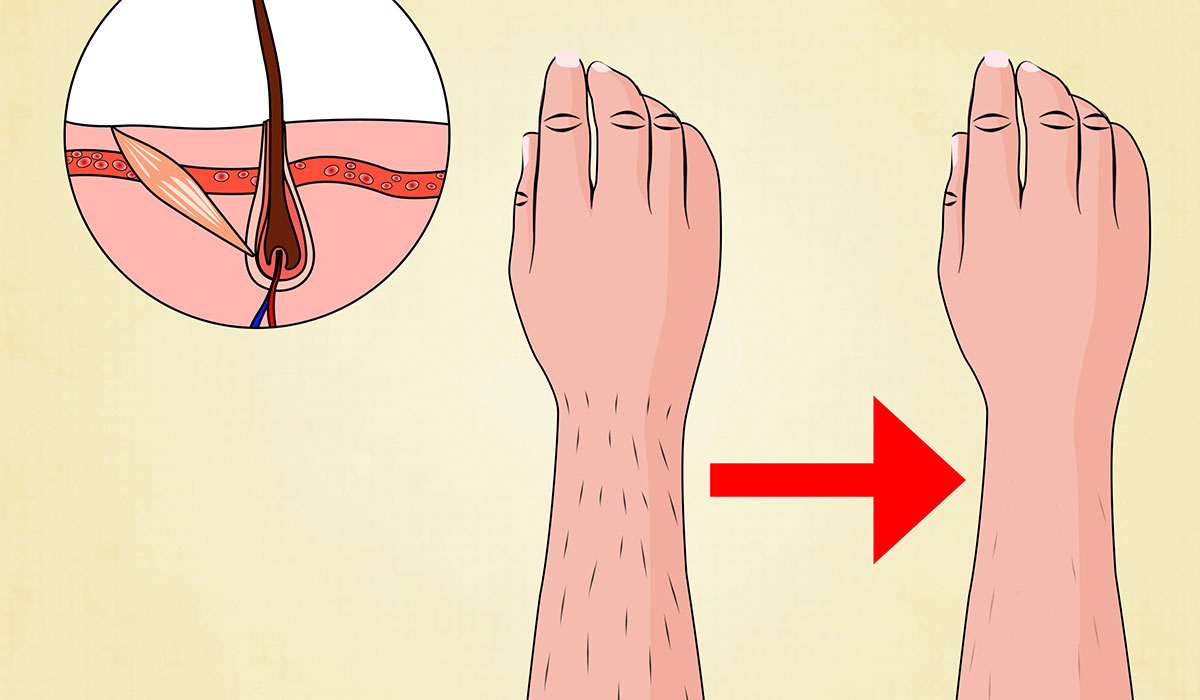 تجربتى مع الليزر بعد 3 جلسات علاج